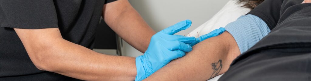 acupuncture-Aldergrove-Physiotherapy-and-Rehabilitation-Centre-Aldergrove-BC-1920x500